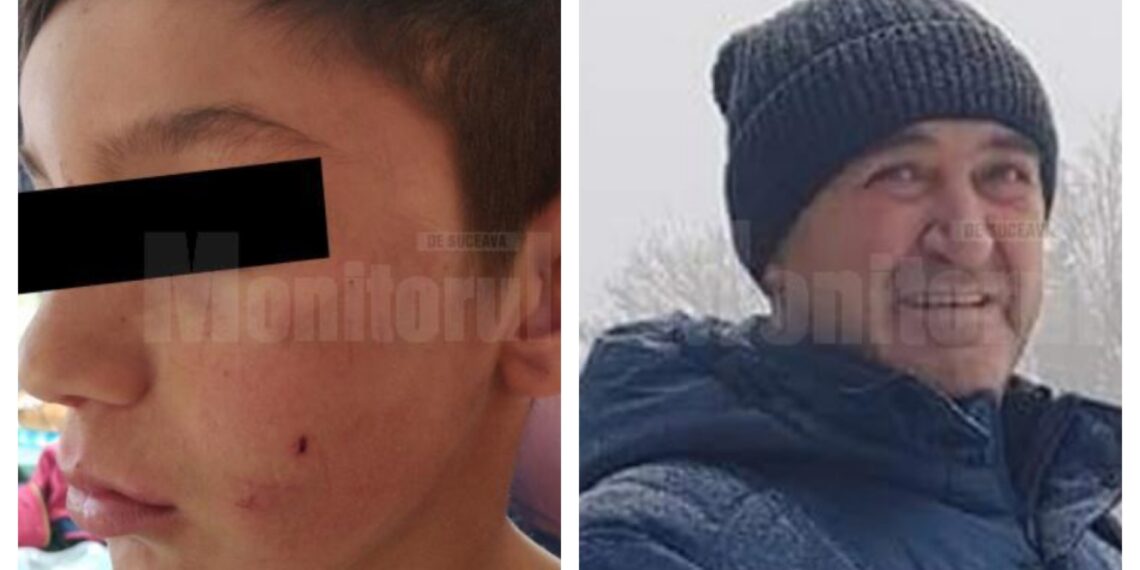 Un patron din Gura Humorului a fost arestat preventiv pentru că a torturat un copil de 11 ani, care ar fi furat de la el trei sticle de whiskey. Victima a fost dezbrăcată, ținută în frig, udată cu apă și bătută zdravăn