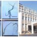 Primul caz de accident vascular cerebral ischemic acut trimis de la SJU Botoșani, tratat cu succes la Spitalul Județean Suceava