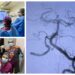 FOTO O femeie de 48 de ani care a suferit un AVC a fost salvată de către o echipă de medici din cadrul SJU Suceava: ”Pacienta poate comunica și mișca toate membrele”