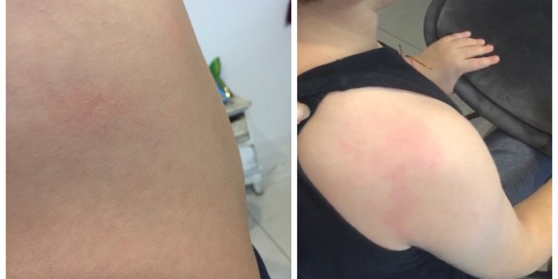 VIDEO O învățătoare din Câmpulung Moldovenesc este acuzată că a bătut un elev de șapte ani. Copilul a avut nevoie de patru zile de spitalizare: ”Nu puteți să spuneți, doamnă, că nu m-ați lovit. Am dovezile pe mine”