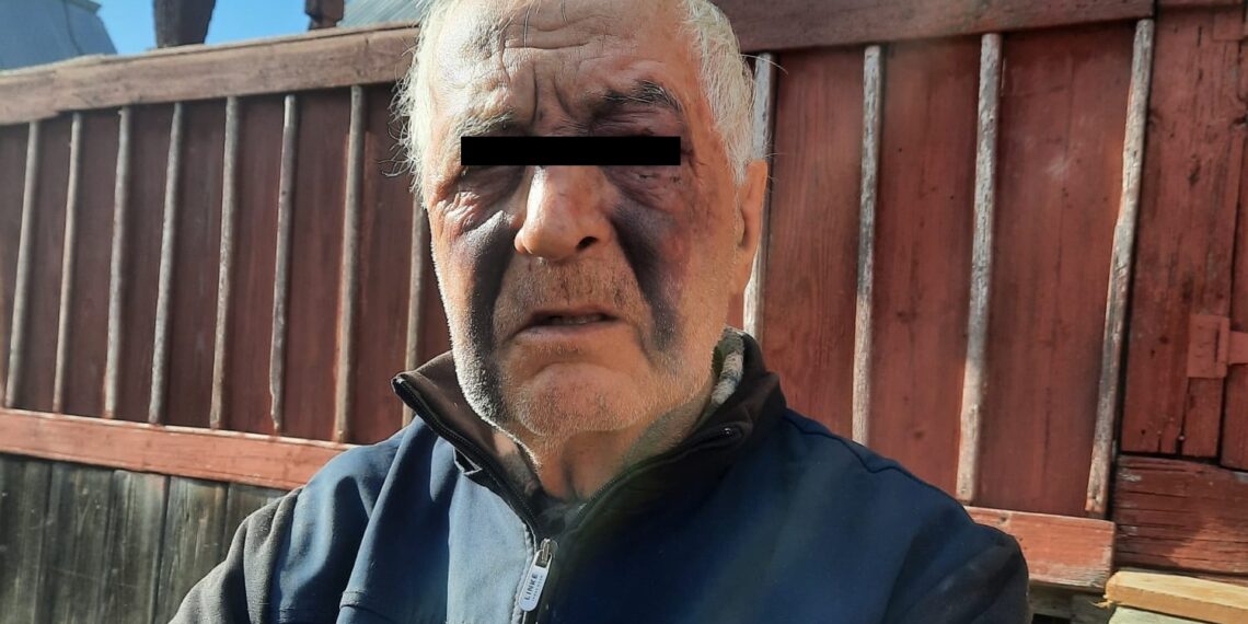 Comunitatea din Moldovița, indignată de șeful de post. Organul de poliție este acuzat că i-ar fi aplicat o bătaie zdravănă unui vecin de 81 de ani