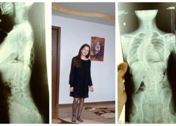 AJUTĂ! Apel disperat al părinților unei fetițe de 12 ani, care are nevoie de o operație de circa 25.000 de euro