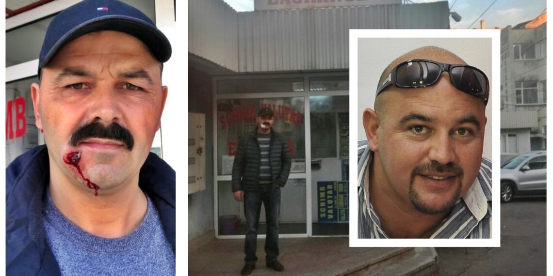 Valutistul Ilie Onuț, condamnat definitiv la un an și nouă luni de închisoare cu suspendare pentru că și-a împușcat fratele în față, ziua în amiaza mare, la doi pași de centrul Sucevei