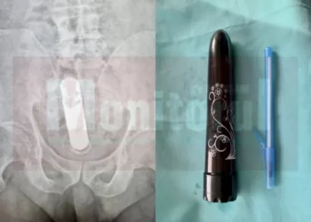 Un sucevean trecut de prima tinerețe a sunat la 112, după ce un vibrator pornit, cu lungimea de 20 de cm, i s-a blocat în anus. Individul se afla în vizită la o femeie din Botoșani