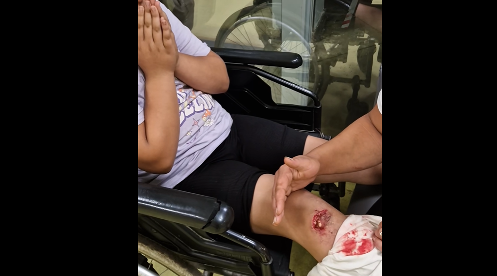 VIDEO Scandal la SJU Suceava, după ce o copilă de 8 ani, cu plagă tăiată la genunchi, a așteptat aproape două ore venirea unui medic: ”Cadrele medicale am văzut că stăteau pe telefoane și râdeau. M-au scos afară și au zis că sună la poliție”