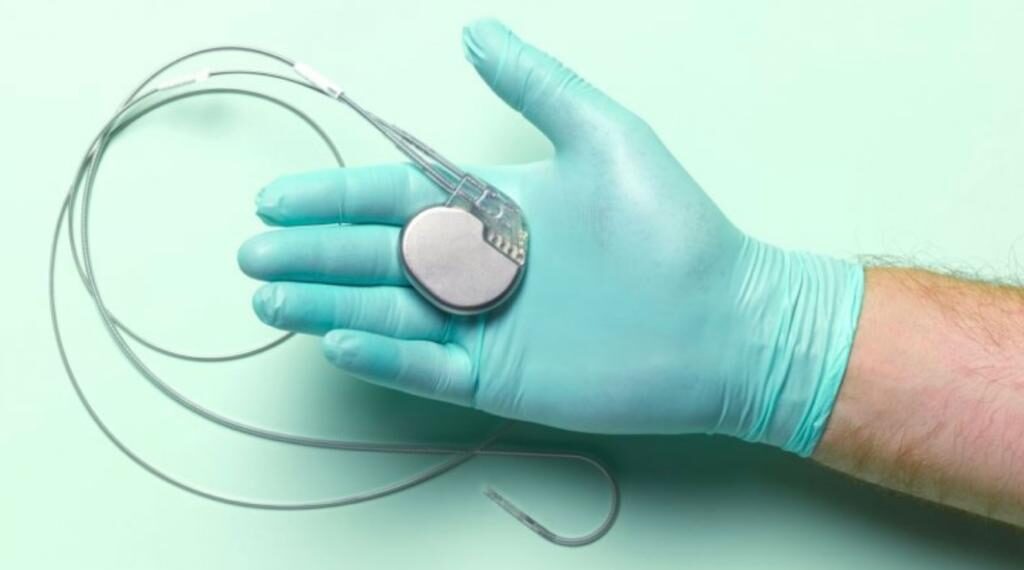 Implantare de stimulatoare cardiace permanente acum și la Spitalul Clinic Județean de Urgență Suceava