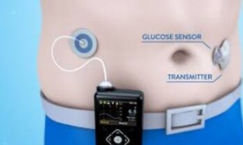 Includerea Spitalului Clinic Județean de Urgență Suceava în programul de inițiere a pompelor și senzorilor de glicemie