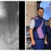 O echipă de abord vascular a realizat în premieră regională procedura de inserție de cateter permanent pentru hemodiliză prin abord transhepatic: ”SCJU Suceava a încheiat anul cu o provocare deosebită și o reușită remarcabilă”