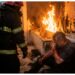 Bărbat din Suceava, ajuns la spital cu mâinile arse după un incendiu izbucnit în baia apartamentului. Încercase să arunce în cadă uleiul aprins din tigaie