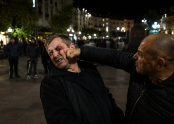 Bărbat reținut după o bătaie pe Platoul Central din Câmpulung Moldovenesc. Victima, lovită în față în apropierea cofetăriei Mon Amour, a ajuns la spital